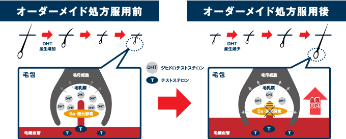 DHTの発生から抑制まで