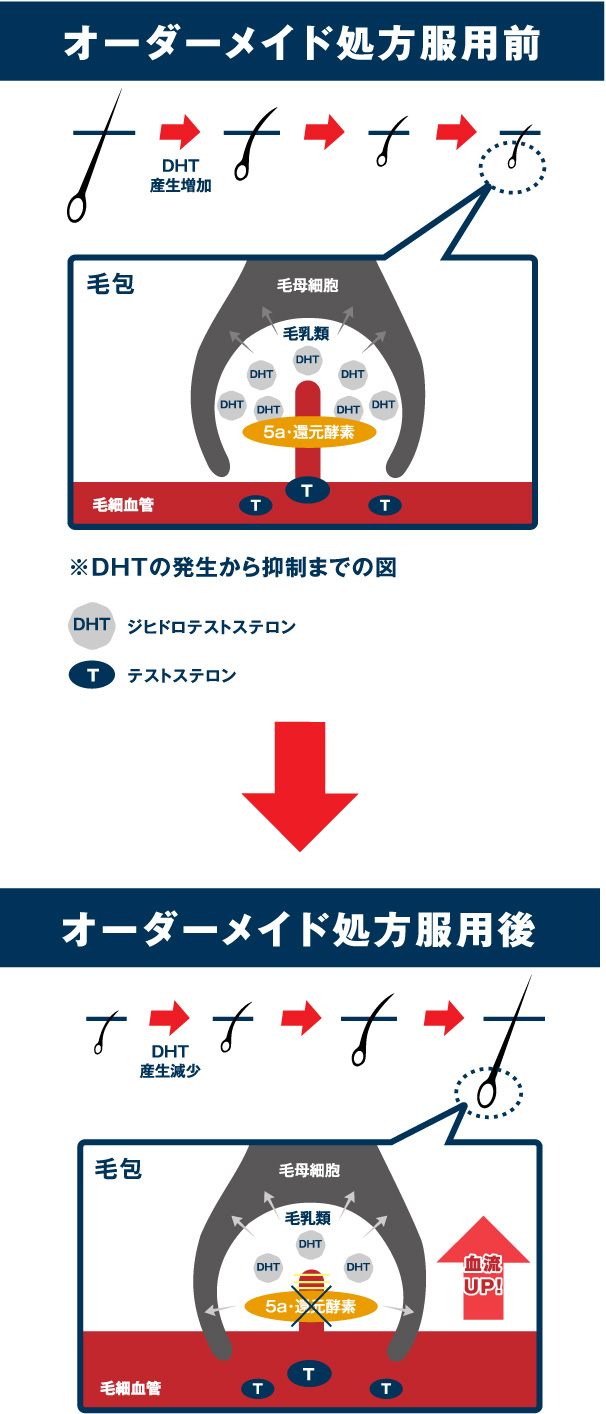 DHTの発生から抑制まで