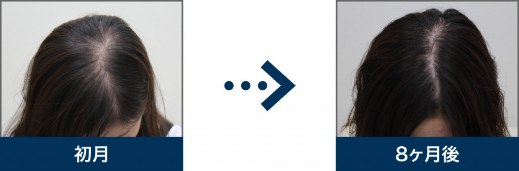 22歳 女性 治療8ヶ月