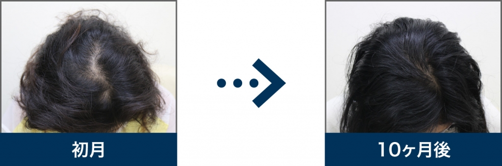 34歳 女性 治療10ヶ月